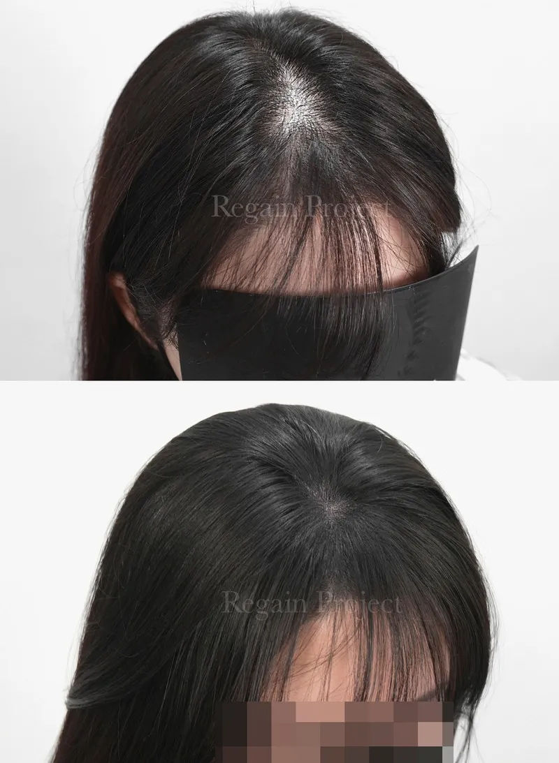 가격 정보와 시술 비용 이미지