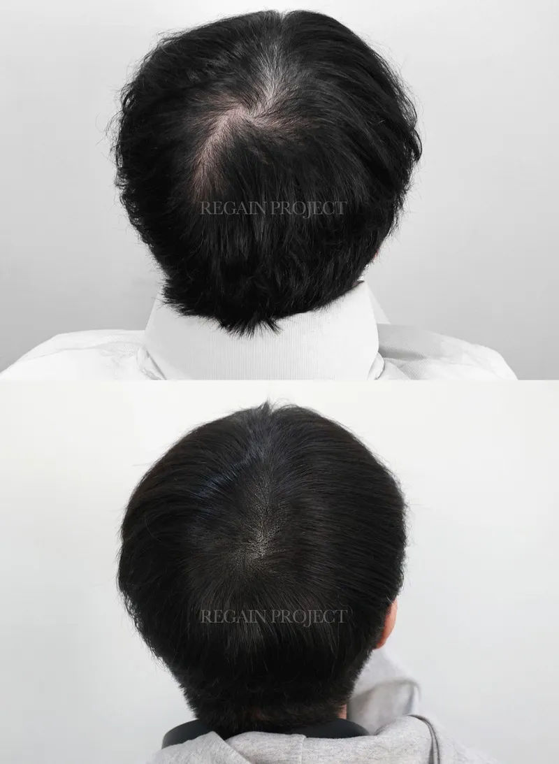 리게인프로젝트 대구본점 이용 시 주의사항 이미지