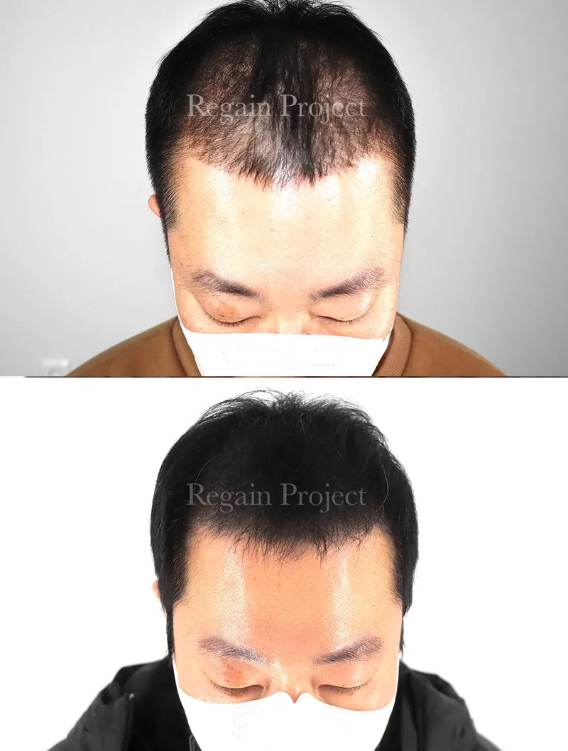 관련 이미지 1