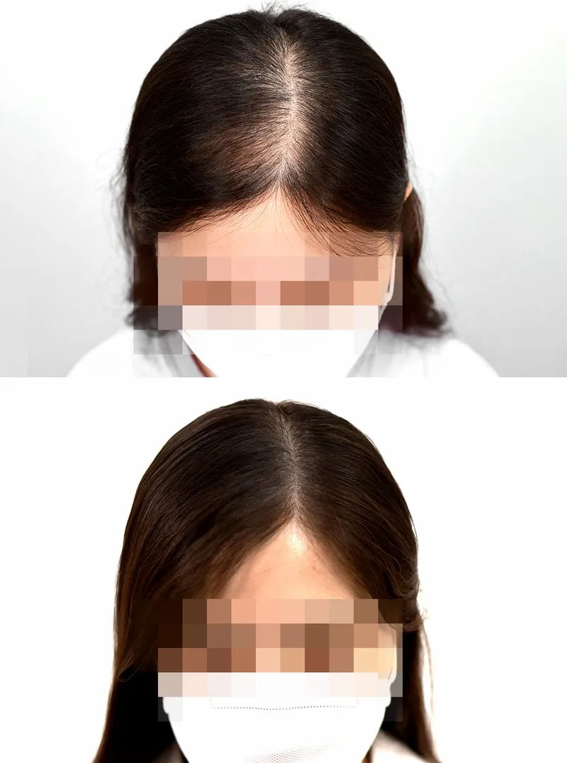 관련 이미지 2