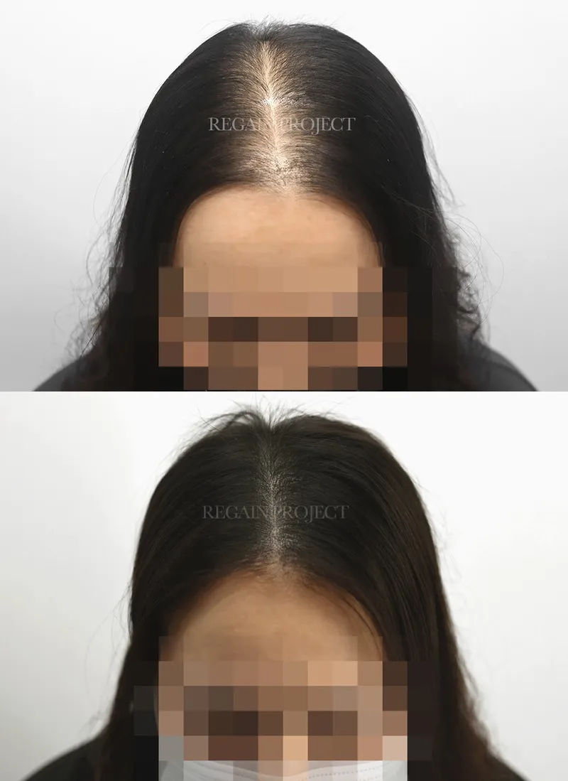 핵심 정보 요약 표 이미지