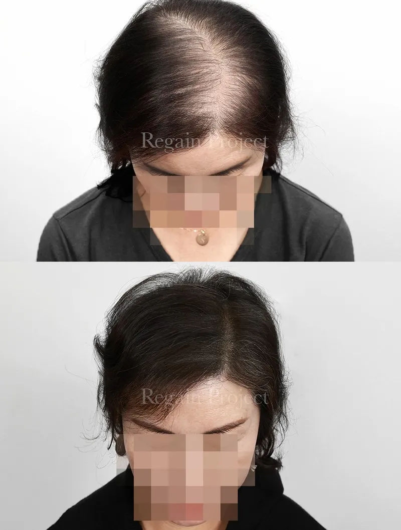 관련 이미지 1