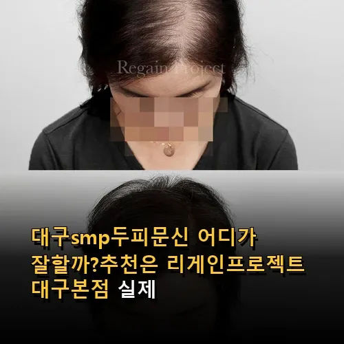 대구smp두피문신 어디가 잘할까?추천은 리게인프로젝트 대구본점 실제 후기와 정보