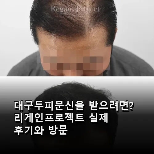 대구두피문신을 받으려면? 리게인프로젝트 실제 후기와 방문 정보 완벽 공유
