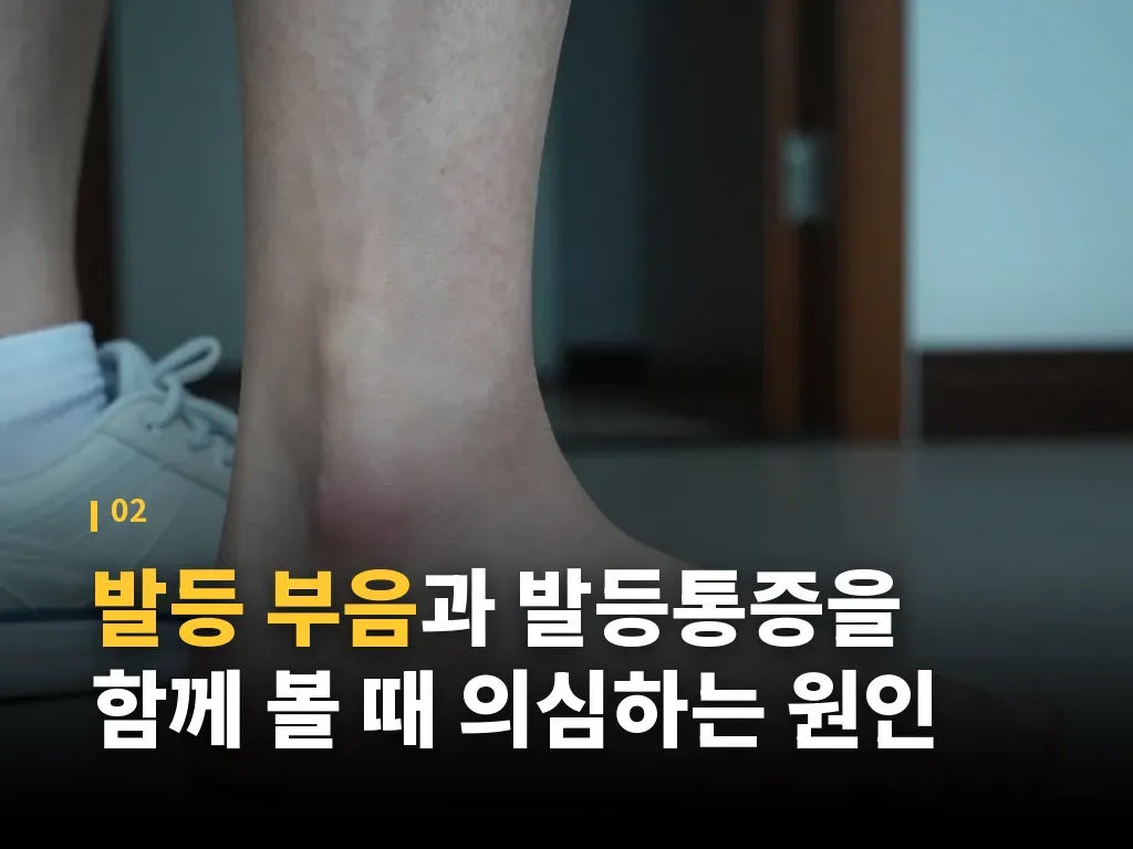 발등부종이 자주 반복될 때 점검할 생활습관 이미지