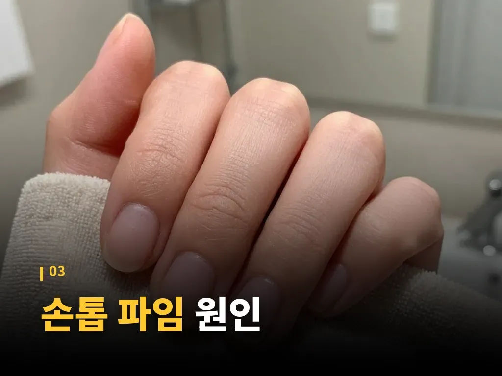손톱 파임 예방 습관 이미지