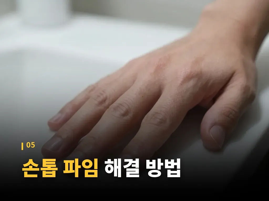 손톱 파임 관리 시 주의할 점 이미지