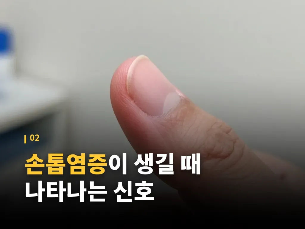손톱염증이 악화되는 이유와 흔한 실수 이미지