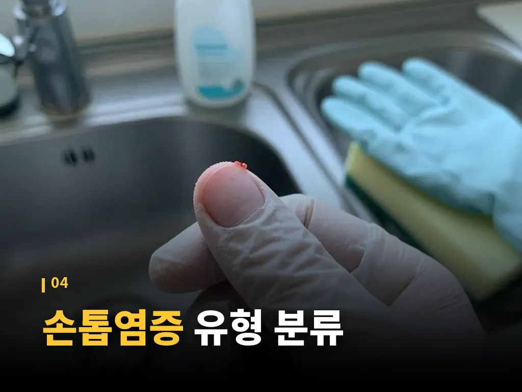 예방법: 재발을 줄이는 생활 습관 이미지