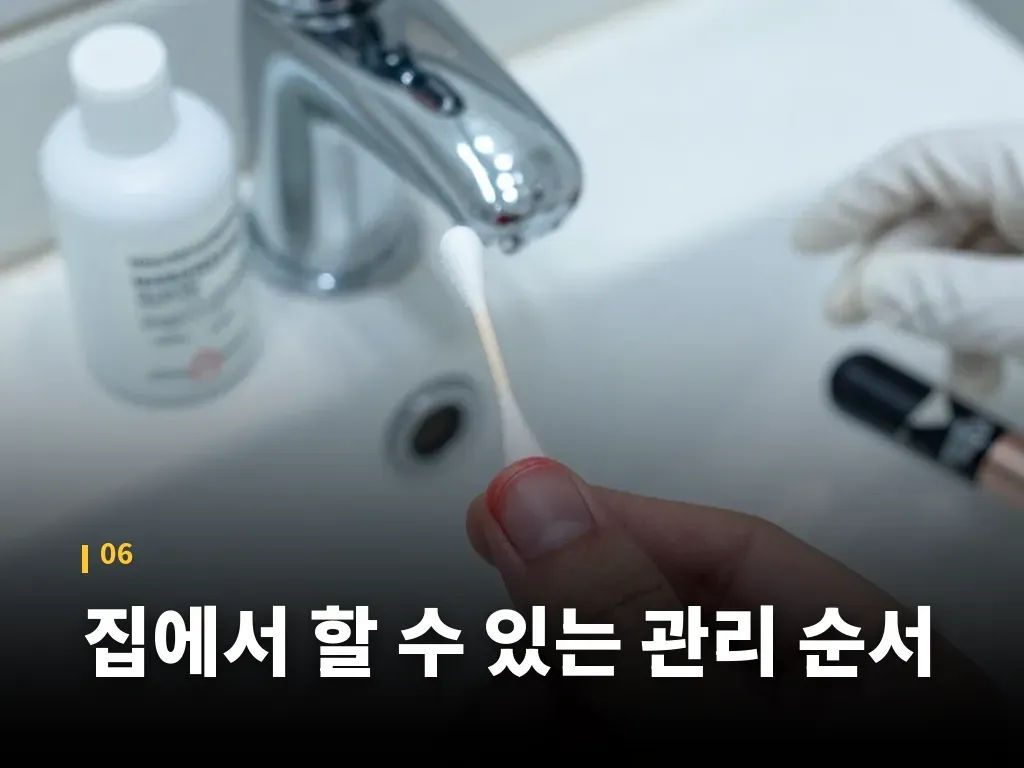 손톱염증과 비슷해 헷갈리는 증상 이미지