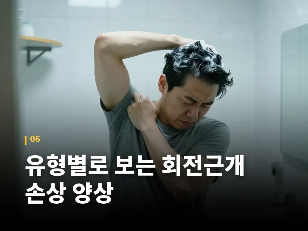 유형별로 보는 회전근개 손상 양상 이미지
