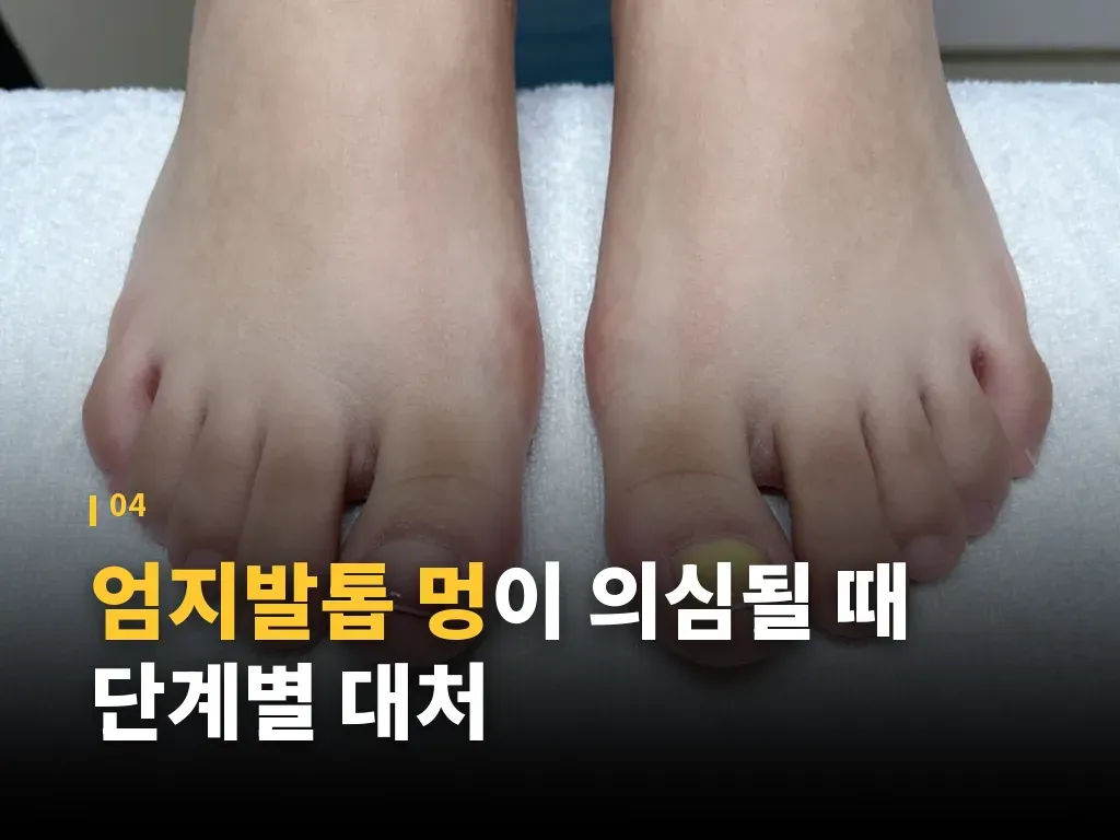 병원 진료가 필요한 신호 이미지
