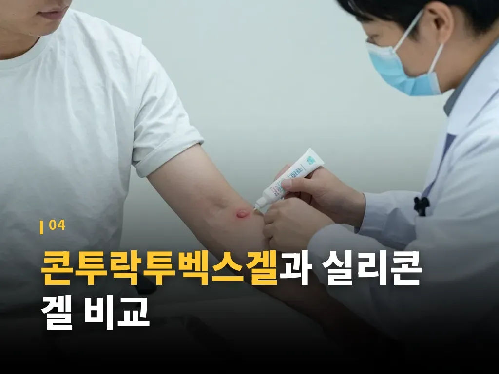 콘투락투벡스겔 구매 전 가격과 대체 선택 이미지