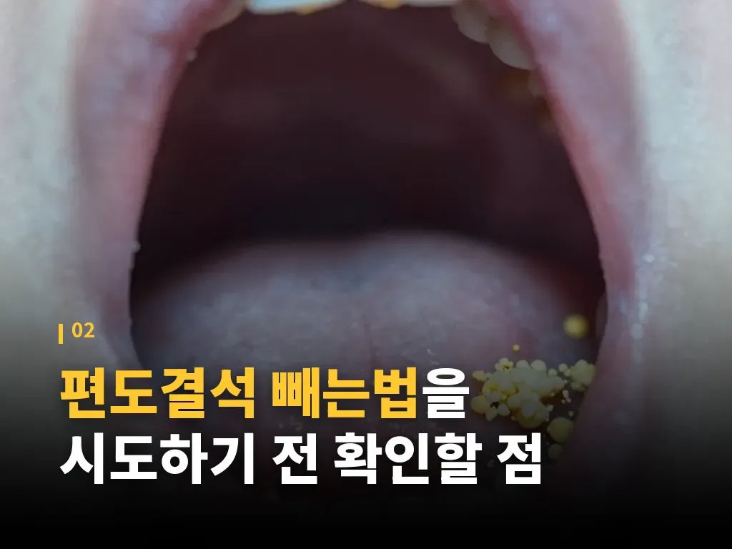 피해야 할 도구와 잘못된 습관 이미지