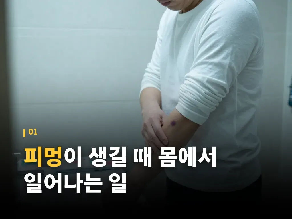 멍 연고와 바르는 제품을 고를 때 이미지