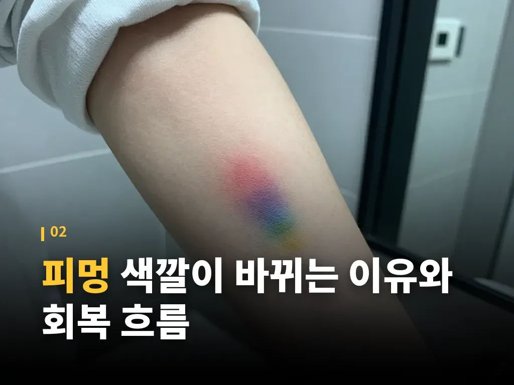 피멍과 비슷해 보이지만 다른 경우 이미지