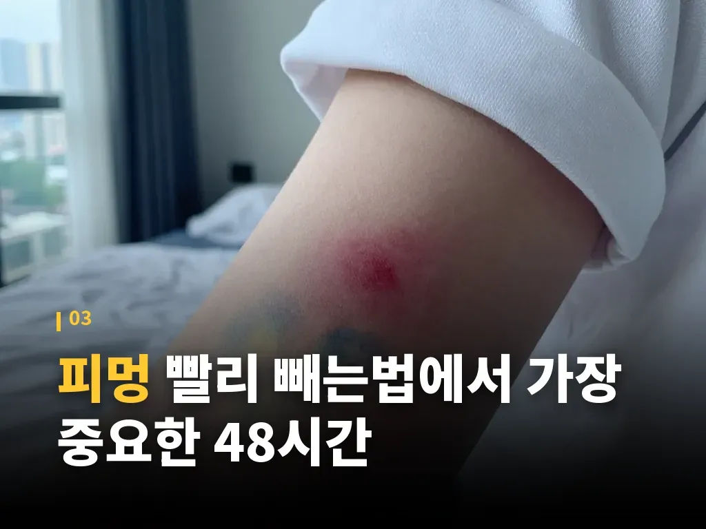 피멍이 잘 생기는 원인과 생활 습관 이미지