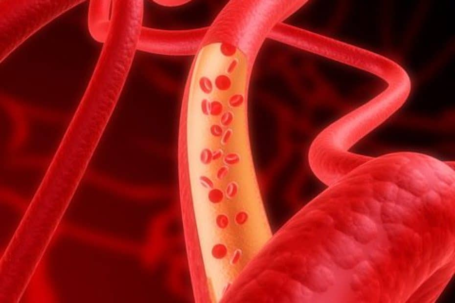 Angiologia Cirurgia Vascular e Angiorradiologia