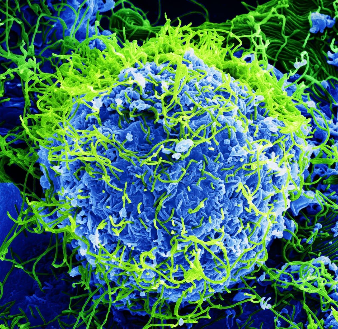 "Beautiful....But Deadly": Colorized scanning electron micrograph of Ebola virus particles (green) found both as extracellular particles and budding particles from a chronically-infected African Green Monkey Kidney cell (blue); 20,000x magnification.