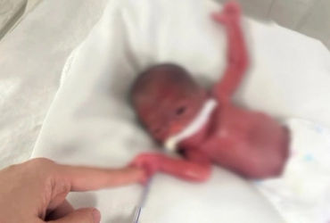 Hành Trình Kỳ Diệu: Bé Gái Sinh Cực Non 24 Tuần, 93 Ngày Hồi Sinh