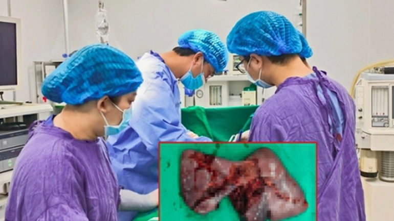 Hành trình chống chọi với sốc mất máu và chấn thương sau tai nạn giao thông