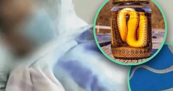 Nguy hại của việc ăn mật rắn và uống rượu rắn: Hậu quả nghiêm trọng từ ký sinh trùng