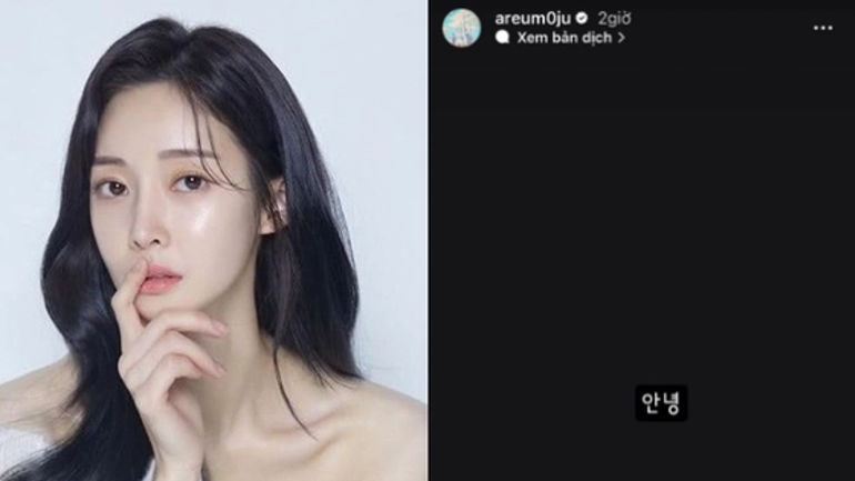 Những Câu Chuyện Về Tâm Lý Xoay Quanh Cuộc Đời Cựu Thành Viên T-ara