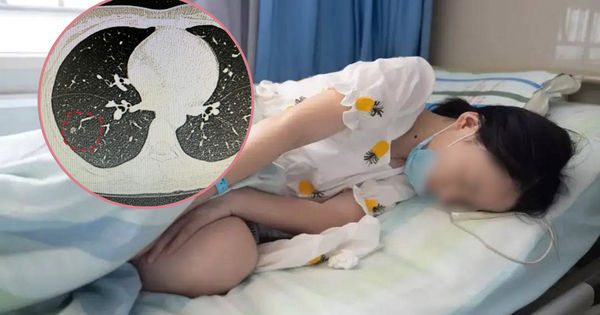 Ung Thư Phổi: Khám Phá và Phòng Ngừa