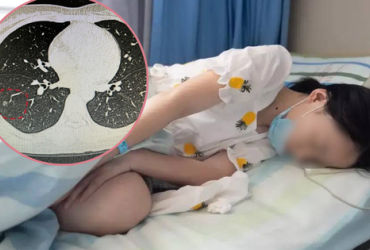 Ung Thư Phổi: Khám Phá và Phòng Ngừa