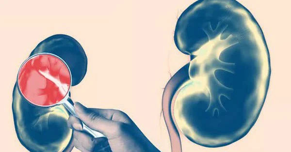 Bảy Bi kịch ẩn sau vẻ đẹp của thận mà bạn thường xuyên bỏ qua