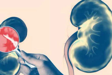 Bảy Bi kịch ẩn sau vẻ đẹp của thận mà bạn thường xuyên bỏ qua