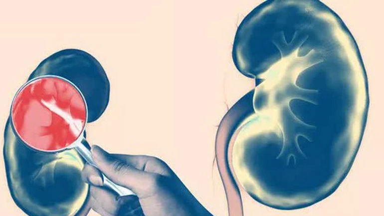 Bảy Bi kịch ẩn sau vẻ đẹp của thận mà bạn thường xuyên bỏ qua