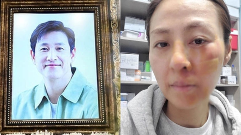 Cuộc Sống Và Bi Kịch của Jeon Hye Jin: Từ Nỗi Đau Mất Chồng Đến Tai Nạn Bất Ngờ