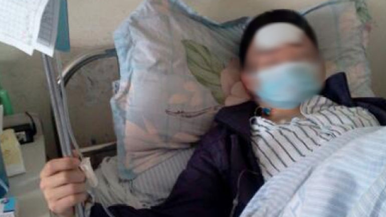 Nguy cơ ung thư da từ thói quen giặt đồ không đúng cách