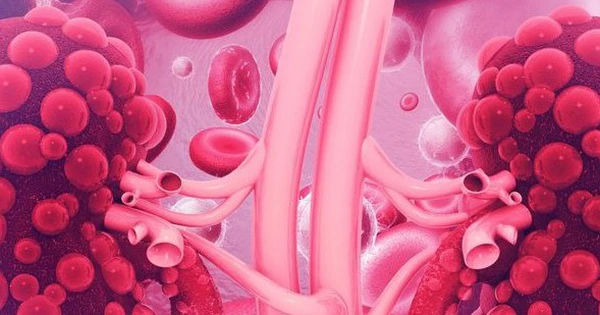 6 dấu hiệu người bị suy thận cần lưu ý