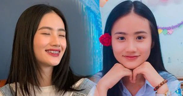 Cuộc hành trình niềng răng của Hoa hậu Huỳnh Trần Ý Nhi