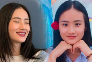 Cuộc hành trình niềng răng của Hoa hậu Huỳnh Trần Ý Nhi