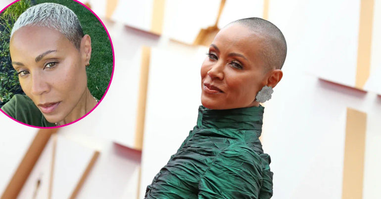 Jada Pinkett Smith's Empowering Journey to Hair Recovery & Gorgeous Transformation!