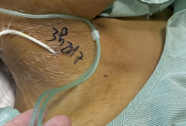 Nam thanh niên suy đa tạng vì ăn xôi chế phẩm màu: Khám phá nguyên nhân và biện pháp phòng tránh