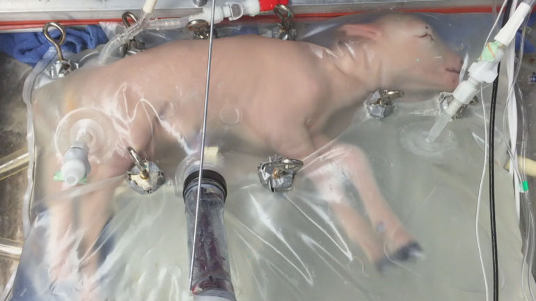 Revolutionary Breakthrough: FDA Advisers Explore Groundbreaking Potential of Artificial Womb for Human Infants