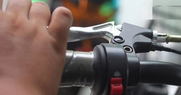 Tai nạn nguy hiểm: Bé 26 tháng tuổi lao xe máy vào tường, sọ não bị chấn thương