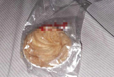 Vụ mất mạng của bé gái 6 tuổi vì bánh kem: Báo cáo bất ngờ của bác sĩ về tình huống không thể ngờ