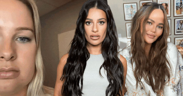 Cắt mỡ má - trào lưu nổi bật nhưng đầy tranh cãi năm 2023