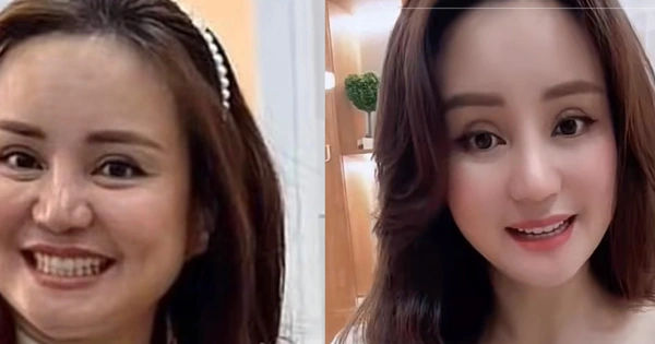 So sánh nhan sắc Vy Oanh giữa ảnh camera thường và ảnh tự chụp
