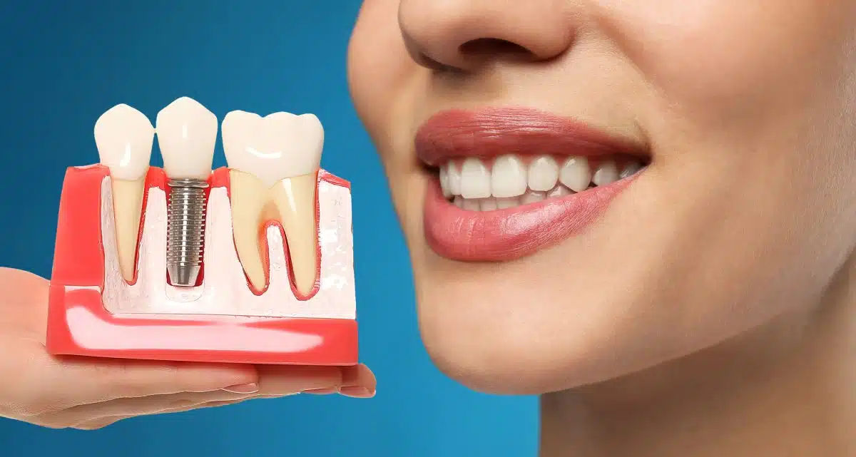 Dental Implants & Tooth Restoration Rock Hill SC | Rock Hill Dentist Pros