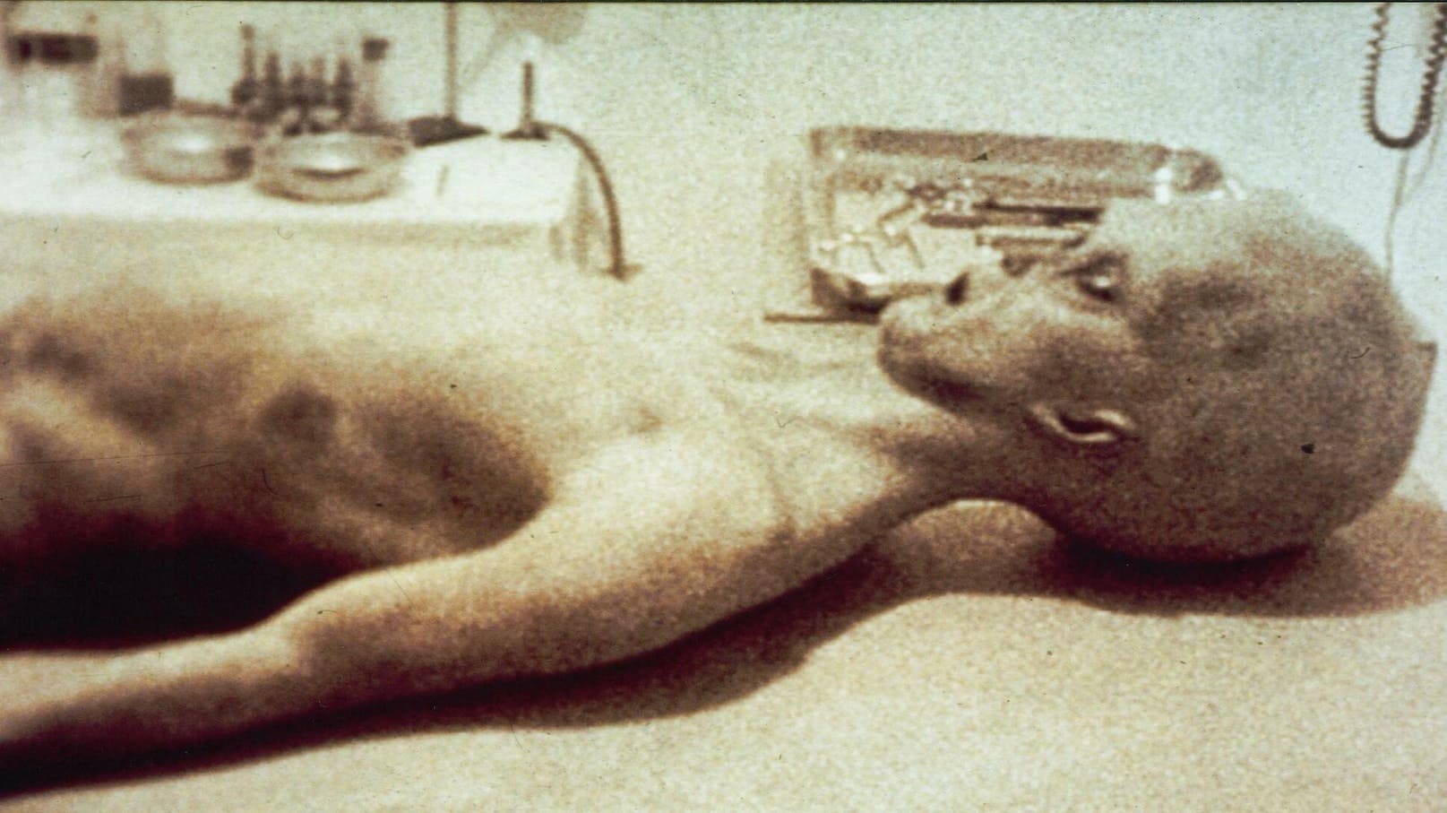 The Alien Autopsy