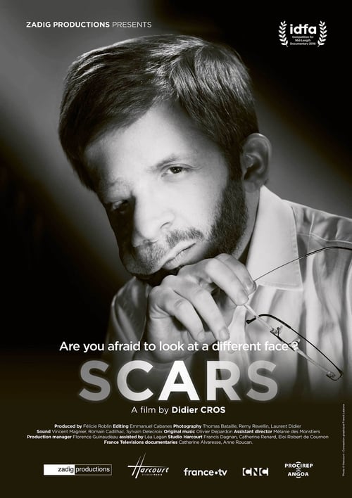 Scars