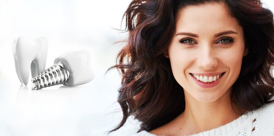 Dental Implants in Dubai