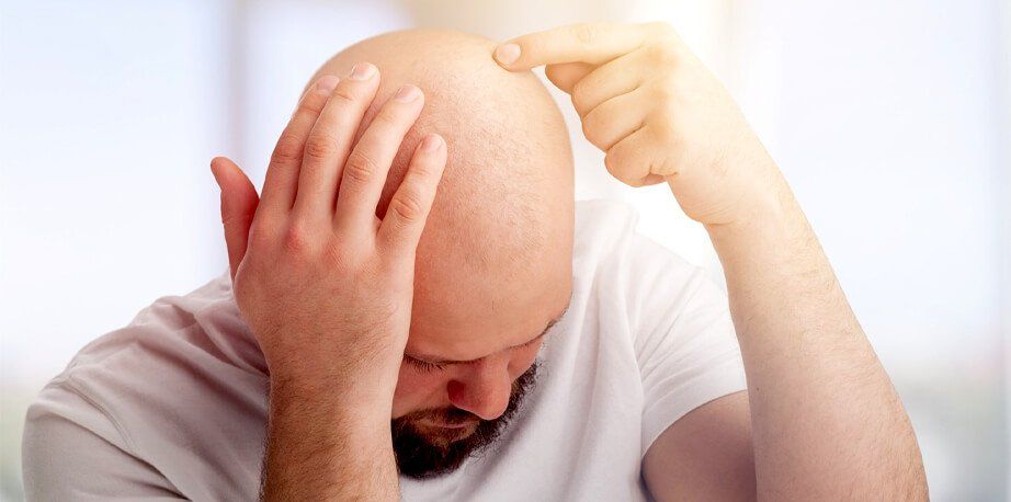 Hair Falling