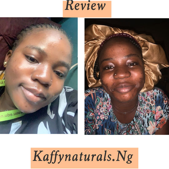 Comment